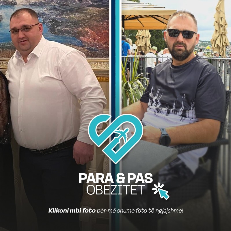 Para & Pas Obezitet