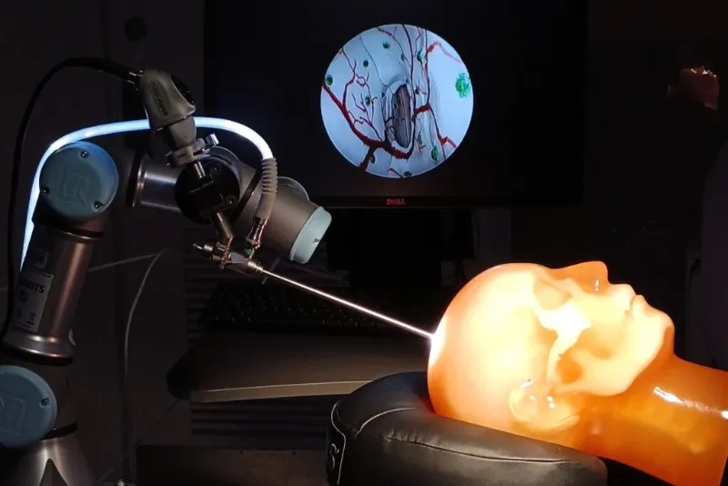 Roli i Teknologjisë Moderne në Operacionet Cerebrale Roli i Teknologjisë Moderne në Operacionet Cerebrale