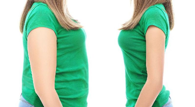 A mund të rifitoni peshë pas operacionit gastric sleeve? A mund të rifitoni peshë pas operacionit gastric sleeve?