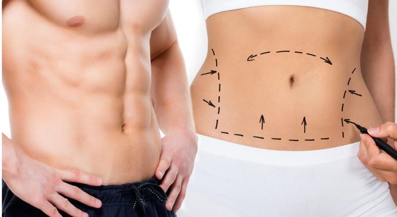 Rimodelimi i trupit pas humbjes ekstreme në peshë – Abdominoplastika si zgjidhje Rimodelimi i trupit pas humbjes ekstreme në peshë – Abdominoplastika si zgjidhje