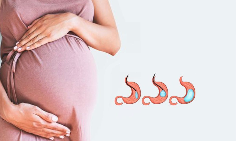 A mund të mbetem shtatzënë pas operacionit gastric sleeve? A mund të mbetem shtatzënë pas operacionit gastric sleeve?