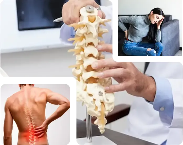 Roli i Imazherisë Mjekësore në Identifikimin dhe Ndjekjen e Skoliozës në Turqi Roli i Imazherisë Mjekësore në Identifikimin dhe Ndjekjen e Skoliozës në Turqi